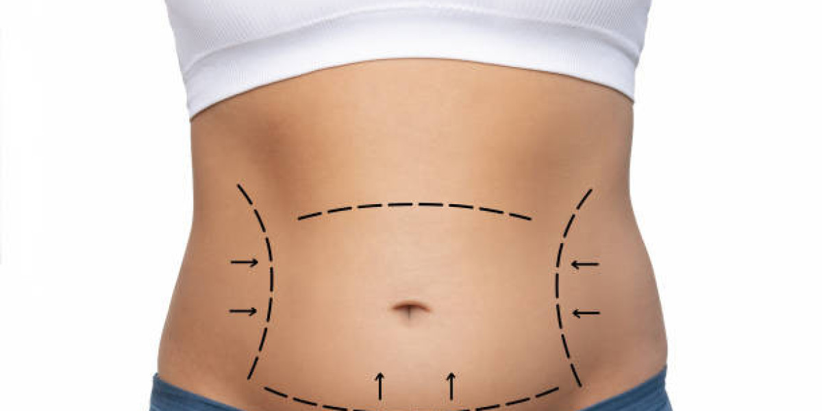 Article Picture