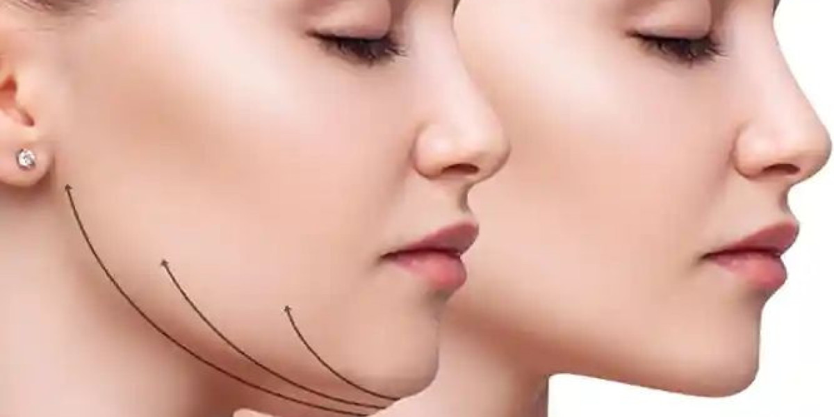 How Facelift Surgery Can Refresh Your Appearance