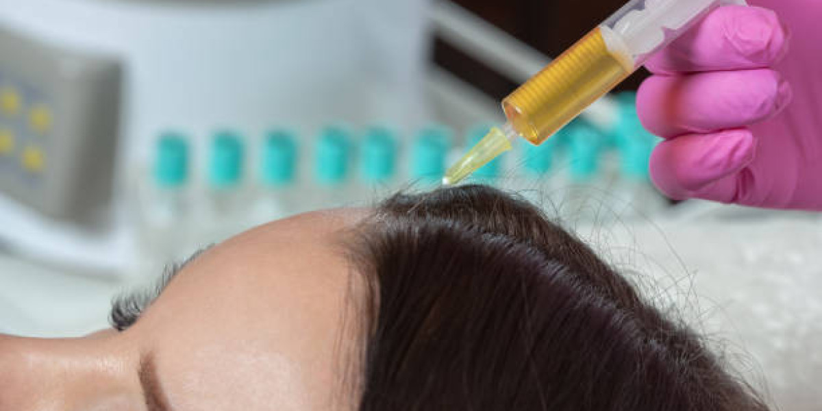 Can PRP Hair Treatment in Abu Dhabi Suit Early Hair Thinning