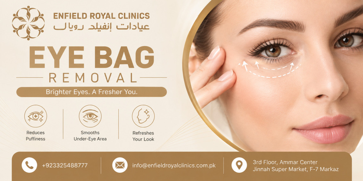 Can Lifestyle Affect Eye Bag Removal Results?