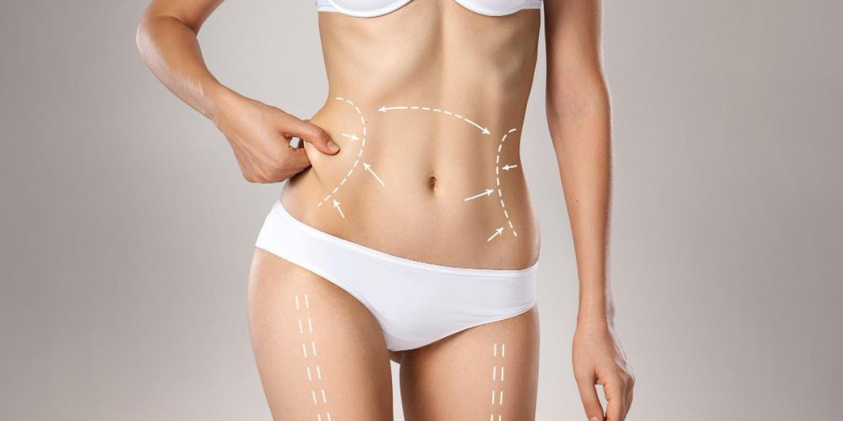 5 Questions to Ask Before Booking Vaser 4D Liposuction