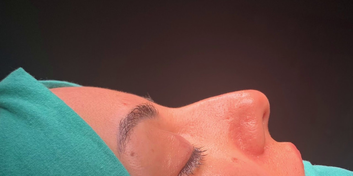 Best Rhinoplasty Clinic in Islamabad: Key Factors Patients Should Consider
