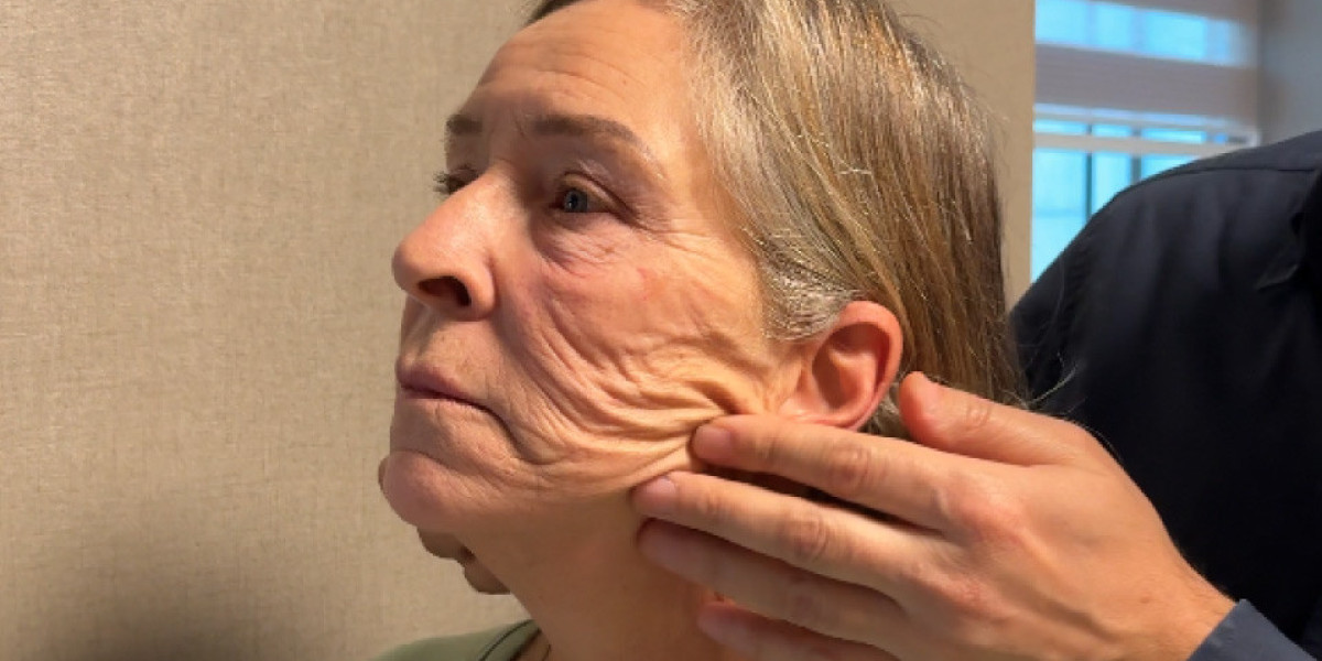 Which Facelift Clinic in Islamabad Is Right for Your Facial Goals?
