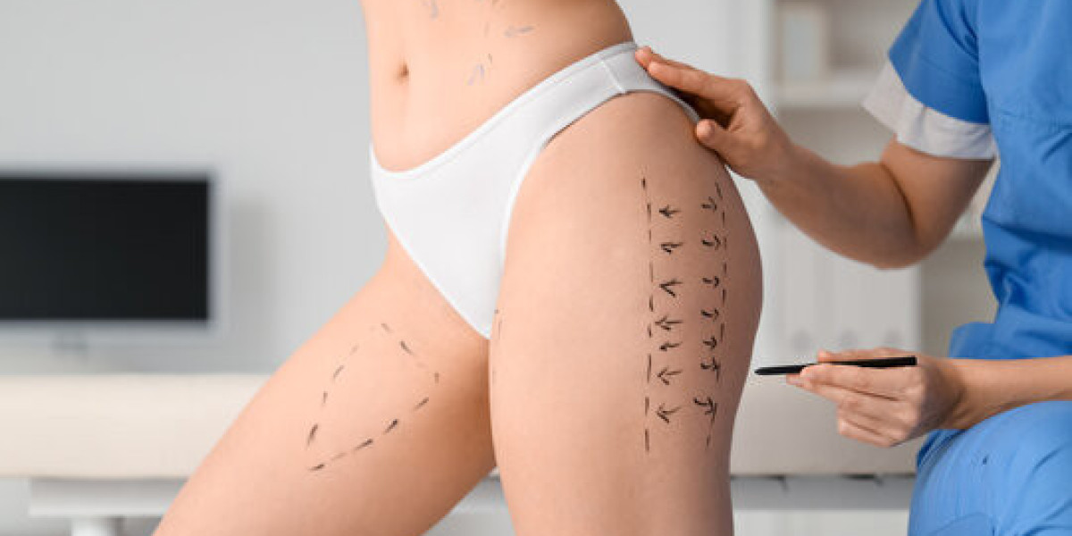Liposuction vs Tummy Tuck in Islamabad: Which Addresses Your Main Concern?